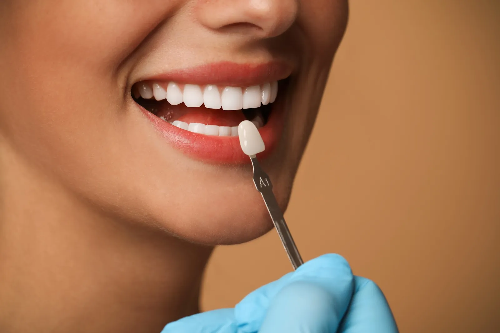 A veneer being matched to a smile