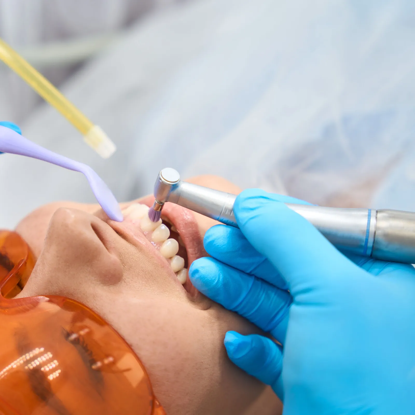 A professional cleaning with a scaler and suction