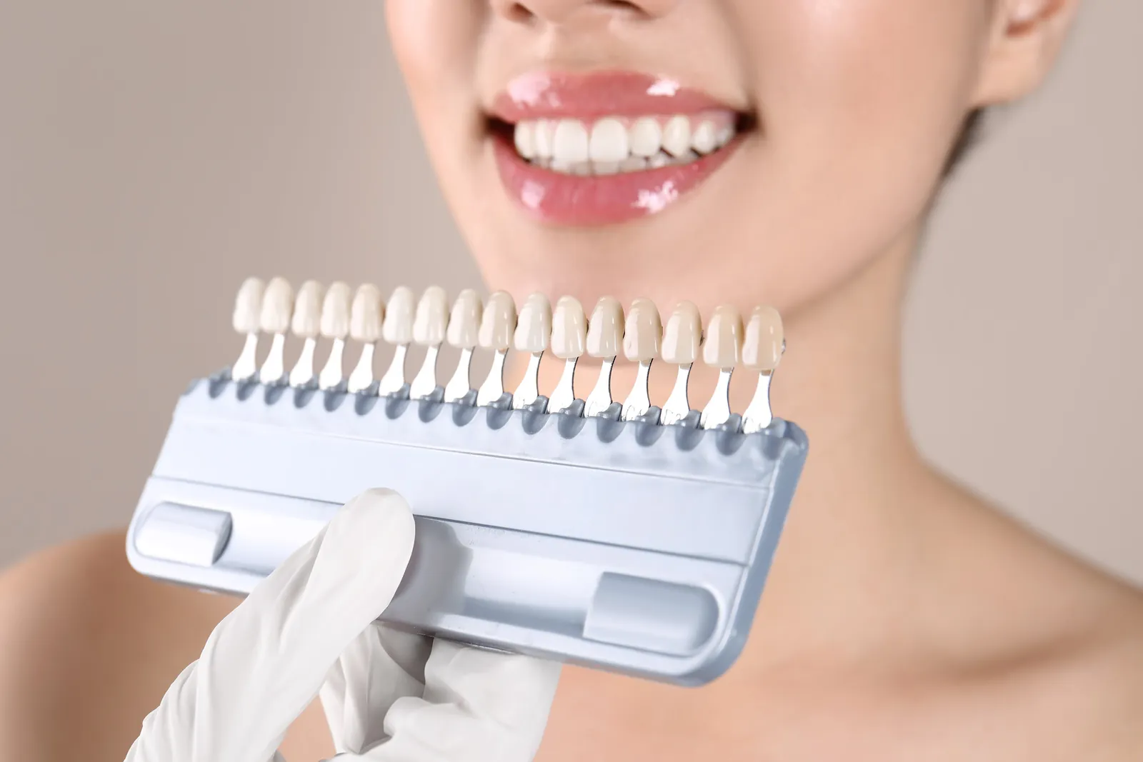 A shade guide held beside a bright smile