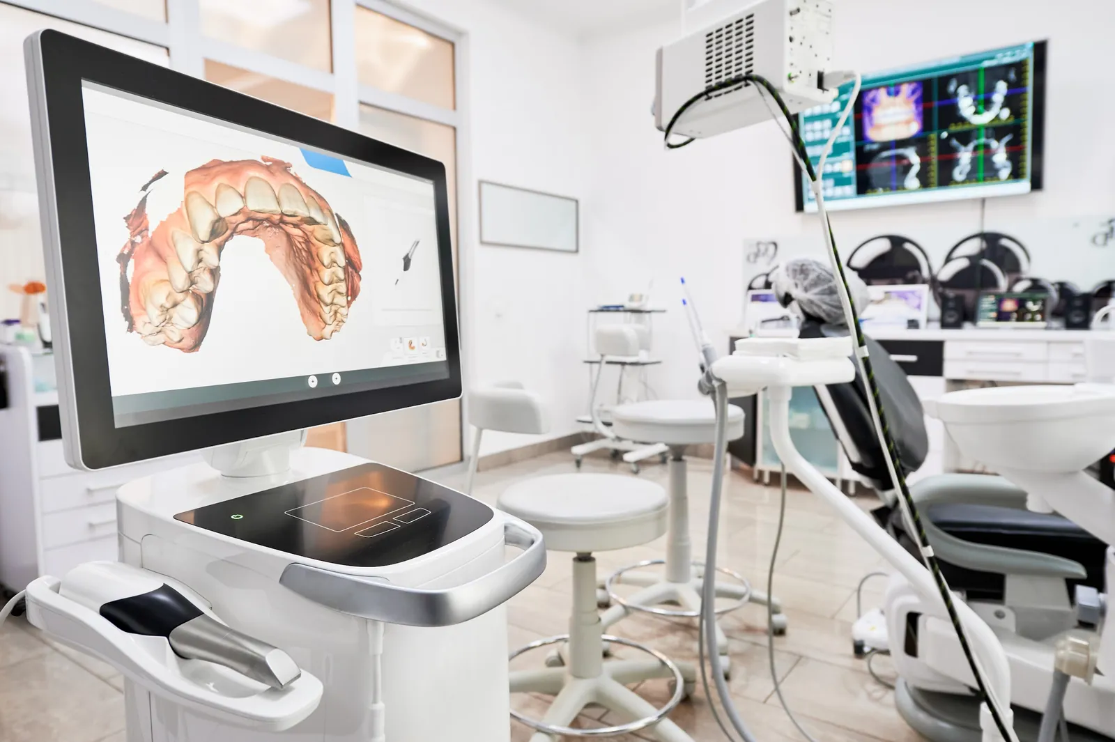 A digital intraoral scan of a dental arch on a treatment-room monitor